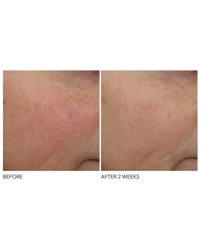 Dr. Dennis Gross Serum Dr. Dennis Gross Advanced Retinol + Ferulic Overnight Wrinkle Treatment (30ml)