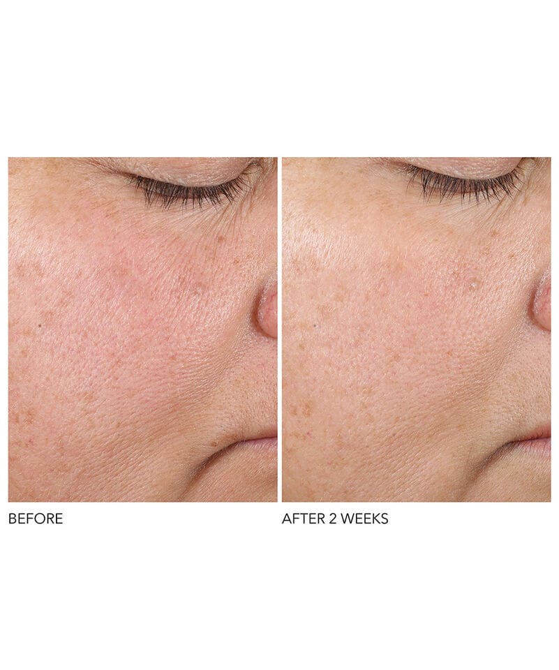 Dr. Dennis Gross Serum Dr. Dennis Gross Advanced Retinol+Ferulic Texture Renewal Serum (30ml)