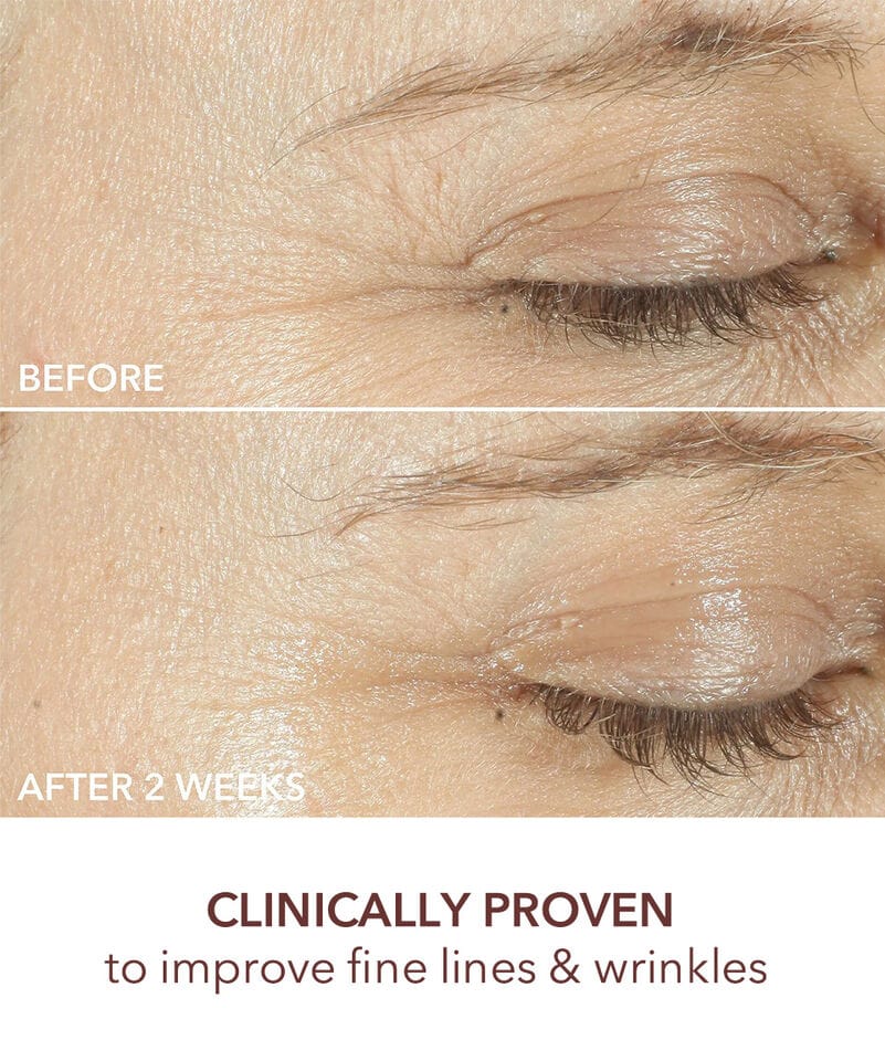 Dr. Dennis Gross Serum Dr. Dennis Gross Advanced Retinol+Ferulic Triple Correction Eye Serum (15ml)