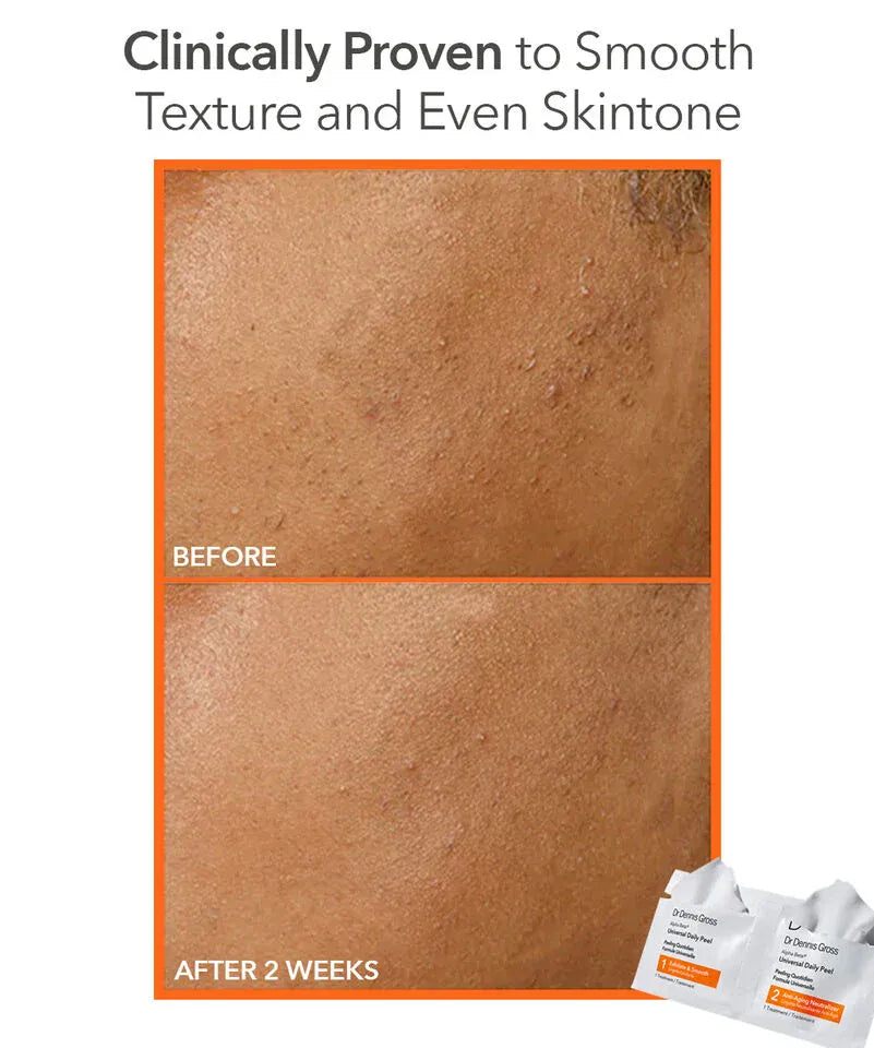 Dr. Dennis Gross Peeling Dr. Dennis Gross Alpha Beta® Face Peel Universal -Servietter 30 pack