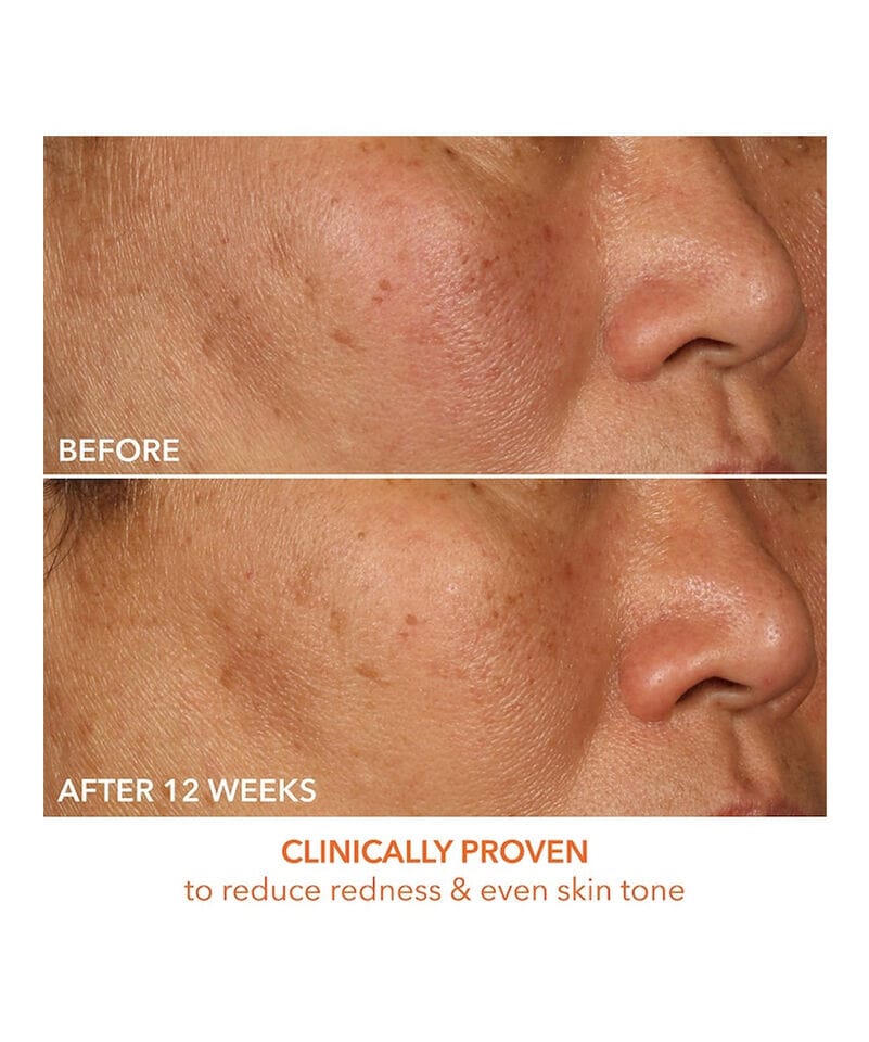 Dr. Dennis Gross Serum Dr. Dennis Gross Vitamin C + Lactic 15% Vitamin C Firm & Bright Serum (30ml)