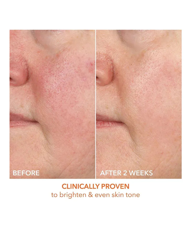 Dr. Dennis Gross Serum Dr. Dennis Gross Vitamin C + Lactic 15% Vitamin C Firm & Bright Serum (30ml)