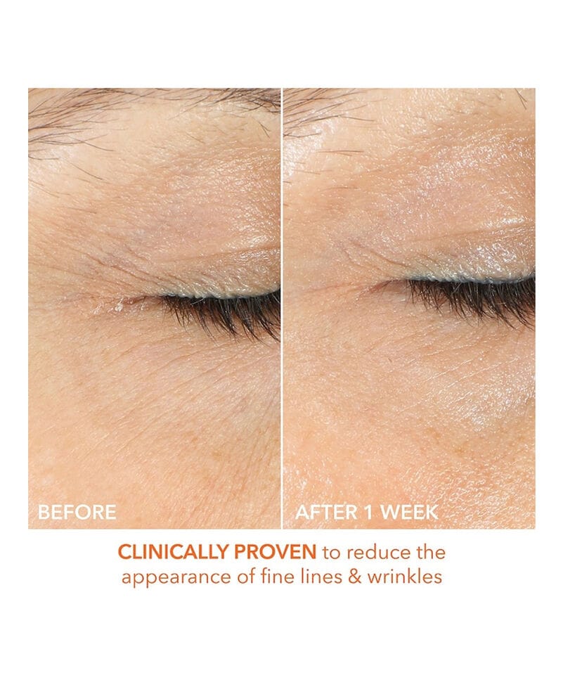 Dr. Dennis Gross Krem Dr. Dennis Gross Vitamin C + Lactic Firm & Bright Eye Treatment (15ml)